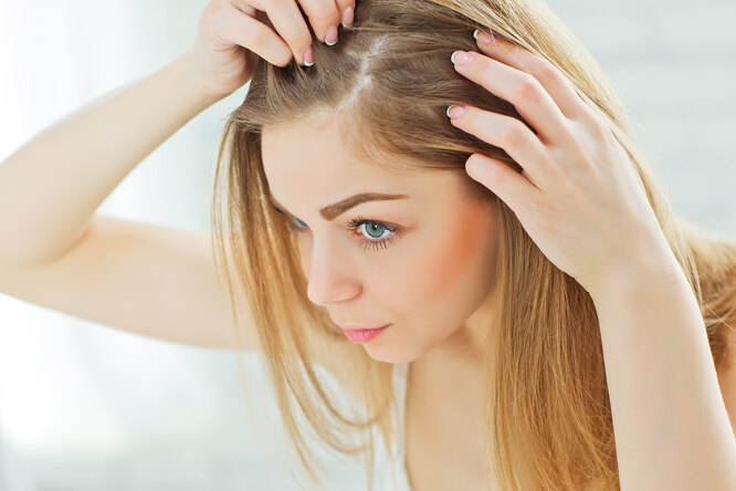 Причины выпадения волос и как это прекратить: советы врача