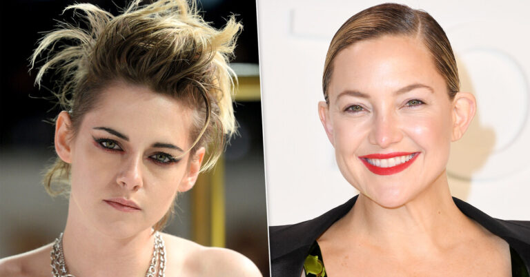 Сами с ушами: звезды, которые не стесняются своих больших ушей