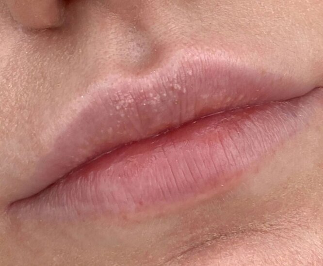 Как выглядит идеальный перманентный макияж губ: 5 примеров «до» и «после», после которых хочется записаться на процедуру