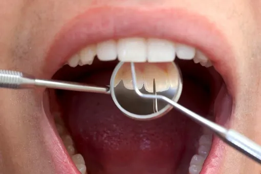 Что происходит, если вовремя не менять зубную щетку: объяснения стоматолога как часто надо менять зубную щетку