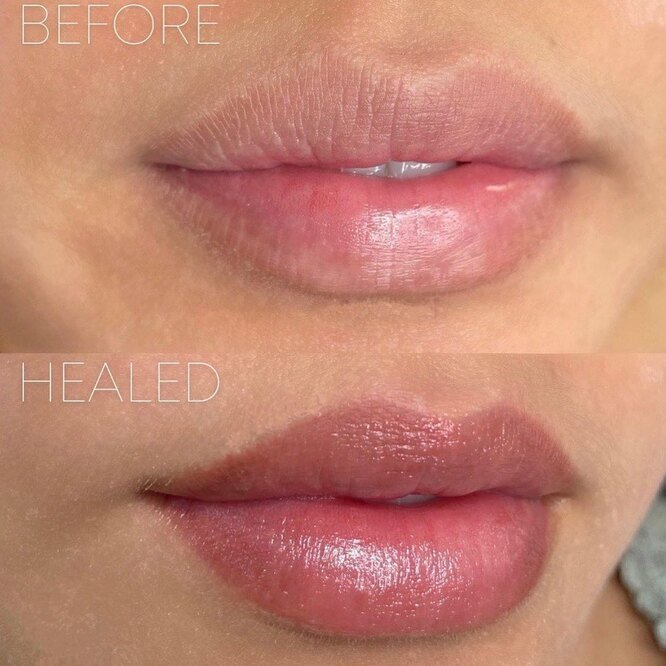 Как выглядит идеальный перманентный макияж губ: 5 примеров «до» и «после», после которых хочется записаться на процедуру