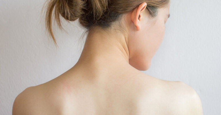 Как избавиться от прыщей на спине: причины и лечение, эффективные средства