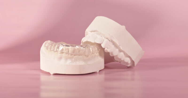 Что такое бруксизм и к каким последствиям для здоровья и красоты он приводит