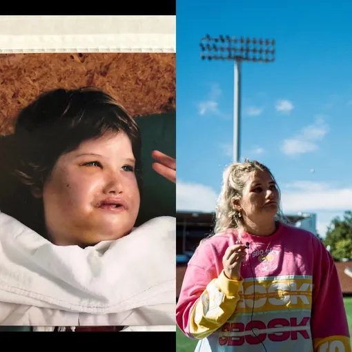 Реальная царевна Несмеяна: как живет девушка, которая не умеет улыбаться Реальная царевна Несмеяна: как живет девушка, которая не умеет улыбаться