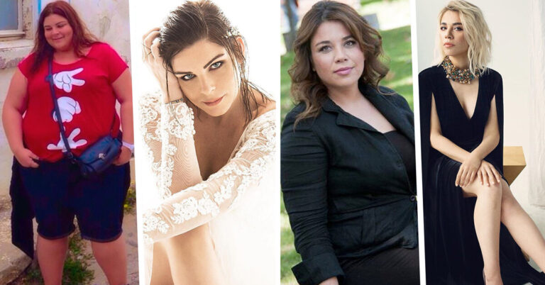 Роскошные турецкие актрисы, похудевшие на 30 и более кг — как они выглядели «до»