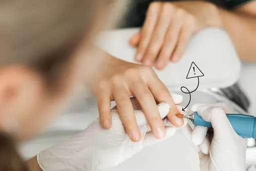 Как провести тест на холестерин во время маникюра: этот признак кричит тебе о проблеме!