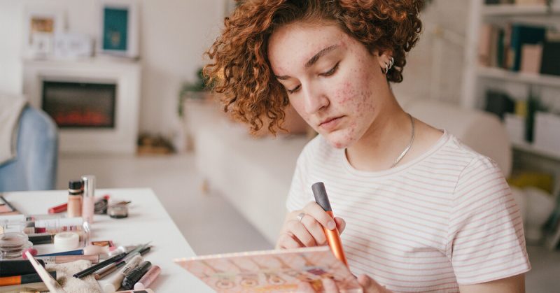 Игра со светом: как правильно замазать прыщи с помощью консилера и хайлайтера